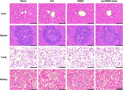 Implantation with SHED sheet induced with homogenate protein of spinal cord promotes functional recovery from spinal cord injury in rats